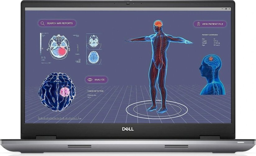 Dell Mobile Precision Workstation 7780 | 17.3 " | WVA | FHD | 1920 x 1080 pixels | Anti-glare | Intel Core i7 | i7-13850HX | 32 GB | SSD 1000 GB | NVIDIA RTX 2000 Ada | GDDR6 | 8 GB | Windows 11 Pro | Keyboard language Estonian | Keyboard backlit | Warranty 36