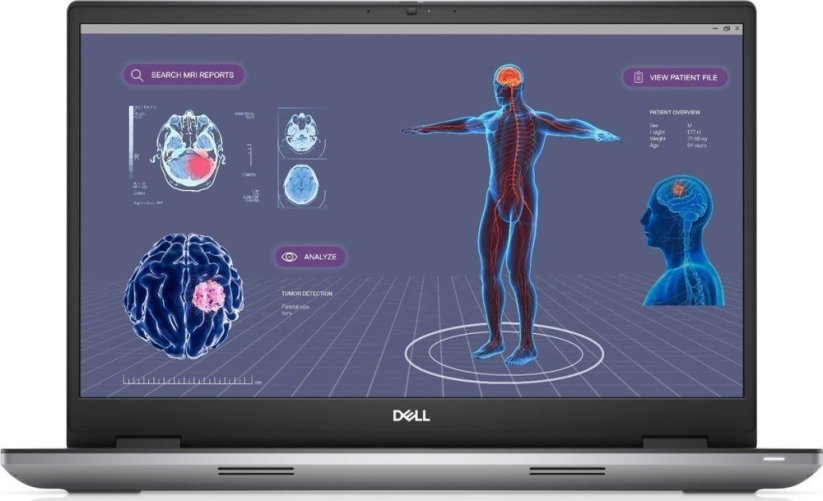 Dell Dell Precision 7780 - Intel Core i9 13950HX / 2.2 GHz - Win 11 Pro - NVIDIA RTX 3500 Ada - 32 GB RAM - 1 TB SSD NVMe, Class 40 - 43.2 cm (17") 1920 x 1080 (Full HD) - 802.11a/b/g/n/ac/ax (Wi-Fi 6E) - Grau - kbd: Deutsch - BTP - mit 3 Jahre Dell ProSu