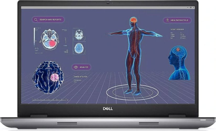 Dell Dell | Mobile Precision 7780 | 17.3 " | WVA | FHD | 1920 x 1080 pixels | Anti-glare | Intel Core i9 | i9-13950HX | 32 GB | SSD 1000 GB | NVIDIA RTX 2000 Ada | GDDR6 | 8 GB | Windows 11 Pro | Keyboard language English | Keyboard backlit | Warranty 36